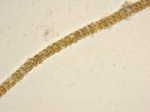 Plagiogramma staurophorum (W.Gregory) Heiberg, author: Mount Allison University