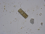Paralia fenestrata Sawai and Nagumo