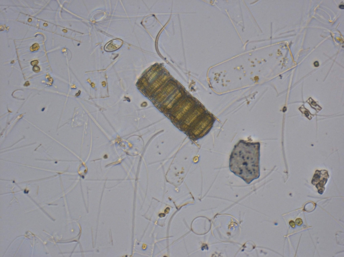 Paralia fenestrata Sawai and Nagumo