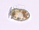 Phytoplankton