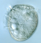 Phytoplankton