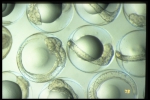 Gadus morhua - embryos, author: Fisheries and Oceans Canada, Jean-Franis St-Pierre