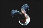 Gastropoda