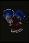Gastropoda