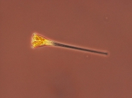 Asterionellopsis glacialis