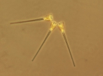 Phytoplankton