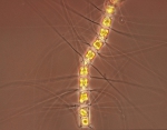 Chaetoceros cinctus, author: Hobson, Lou