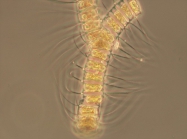 Chaetoceros debilis