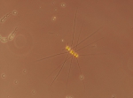 Diatoms