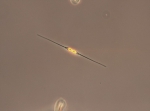 Diatoms