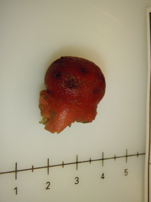 Anthomastus Anthomastus