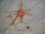 Cnidarians