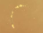Diatoms