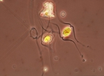 Chaetoceros cinctus valve view, author: Hobson, Lou