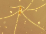 Chaetoceros concavicornis, author: Hobson, Lou