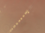 Diatoms