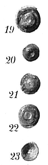 Ammodiscus catinus Ammodiscus catinus
