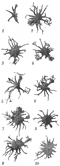 Astrorhiza limicola Astrorhiza limicola