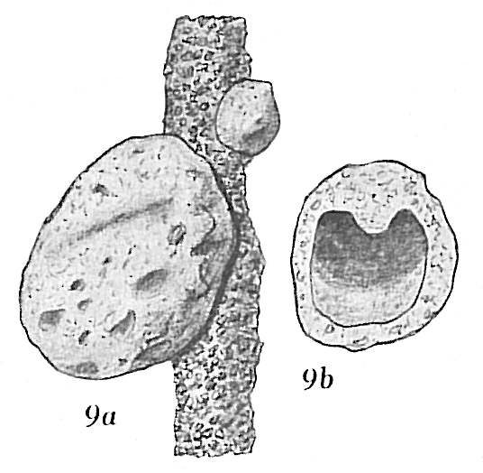 Crithionina mamilla Crithionina mamilla