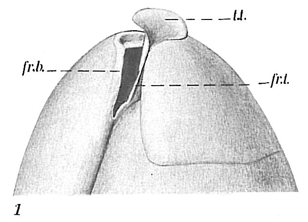 Globobulimina sp. Globobulimina sp.
