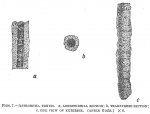 Astrorhiza tenuis