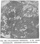 Placopsilina cenomana