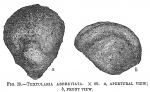 Textularia abbreviata