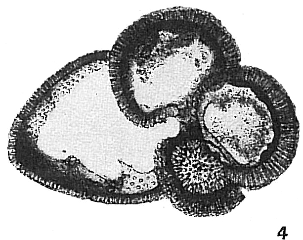 Globigerina sacculifera Globigerina sacculifera
