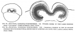 Biloculina vespertilio