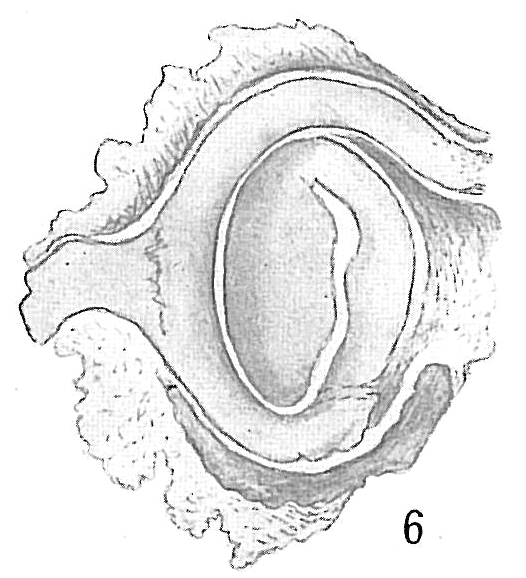 Nubecularia lucifuga Nubecularia lucifuga