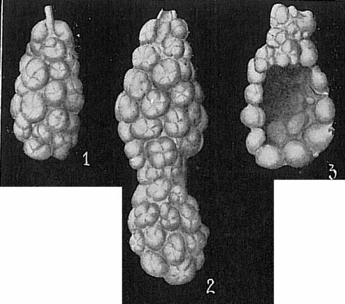 Reophax agglutinatus Reophax agglutinatus