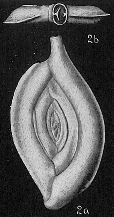 Spiroloculina grateloupi acescata Spiroloculina grateloupi acescata