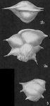 Ehrenbergina albatrossi