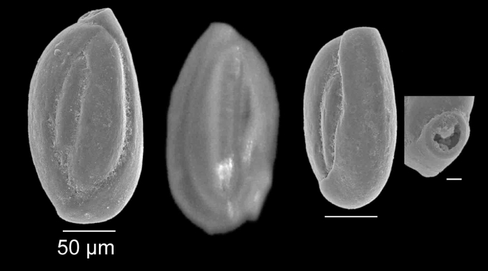 Quinqueloculina laevigata d´Orbigny, 1839 Quinqueloculina laevigata d´Orbigny, 1839