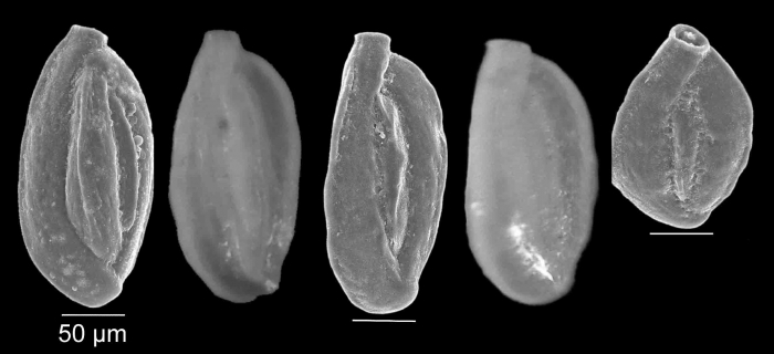 Quinqueloculina stelligera Schlumberger, 1893 Quinqueloculina stelligera Schlumberger, 1893