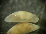 Ostracoda