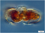 Conjugating pair of Acanthostomella norvegica