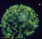 Phaeocystis