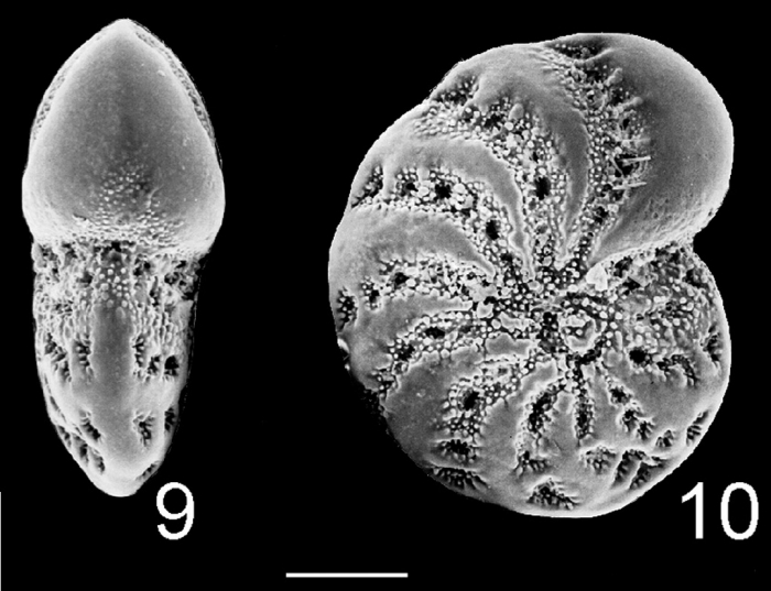 Elphidium advenum limbatum PARATYPE Elphidium advenum limbatum PARATYPE
