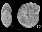 Elphidium advenum macelliforme