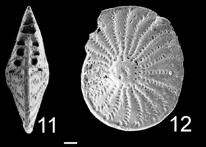 Elphidium crispum waiwiriensis PARATYPE Elphidium crispum waiwiriensis PARATYPE