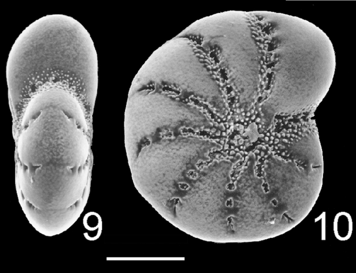 Elphidium excavatum s.s. NZ Elphidium excavatum s.s. NZ