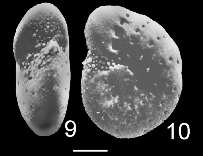Elphidium sydneyense HOLOTYPE Elphidium sydneyense HOLOTYPE