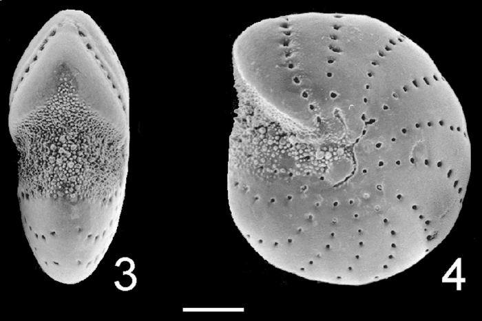 Elphidium hawkesburiense Australia Elphidium hawkesburiense Australia