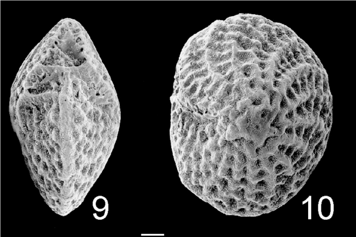 Elphidium ingressans TOPOTYPE NZ Elphidium ingressans TOPOTYPE NZ