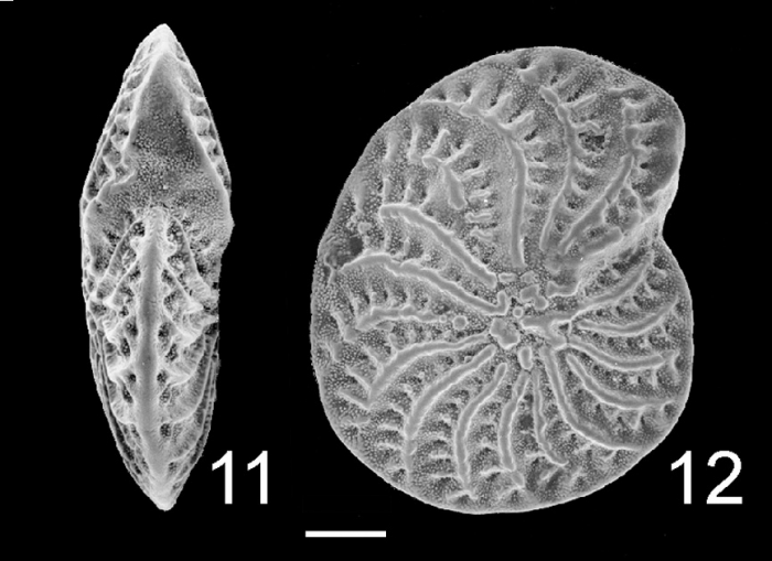 Elphidium macellum Australia Elphidium macellum Australia