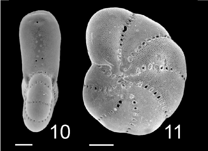 Elphidium poeyanum West Indies Elphidium poeyanum West Indies