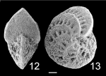 Elphidium pseudoinflatum NZ