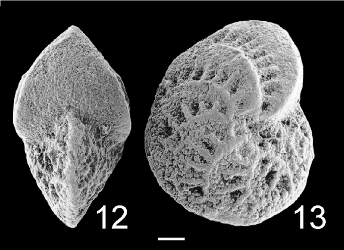 Elphidium pseudoinflatum NZ Elphidium pseudoinflatum NZ