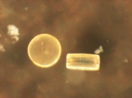 Coscinodiscus